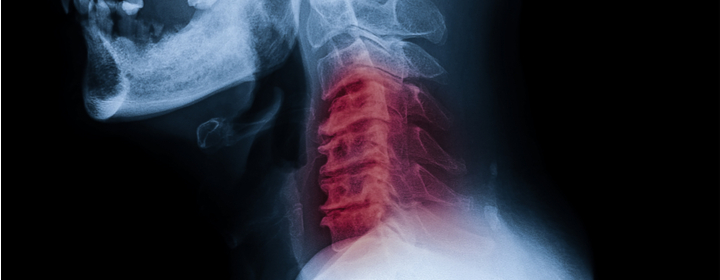 Law Offices of James F. Aspell, P.C West Hartford, CT Office